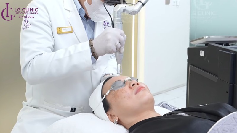 trị nám bằng laser bao nhiêu tiền