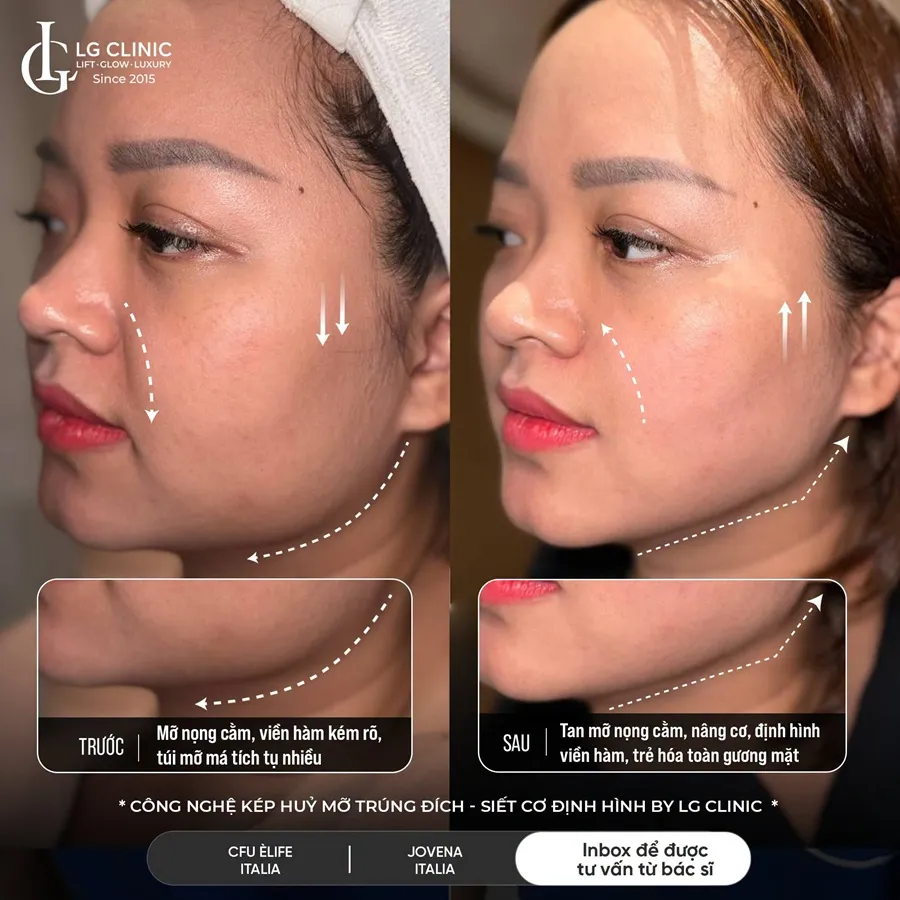 Ảnh BA công nghệ kép