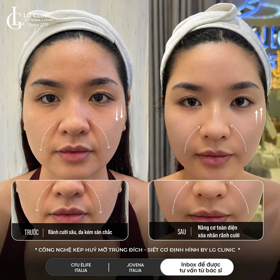 Ảnh BA công nghệ kép
