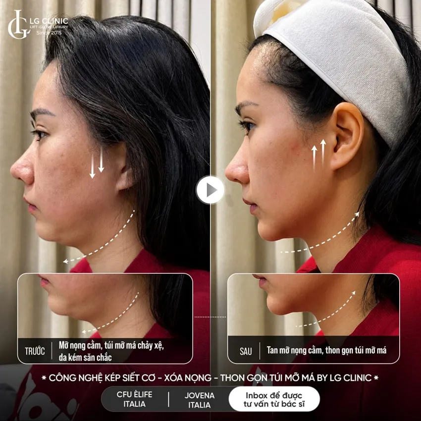 hình ảnh ba công nghệ kép
