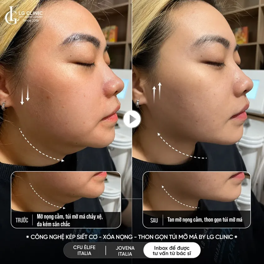 hình ảnh ba công nghệ kép