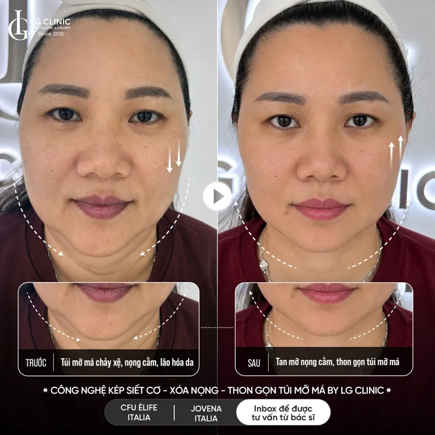 hình ảnh ba công nghệ kép