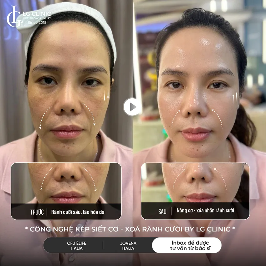 hình ảnh ba công nghệ kép