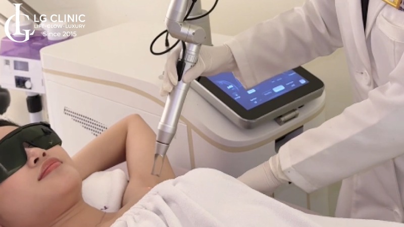laser pico có bỏng da không