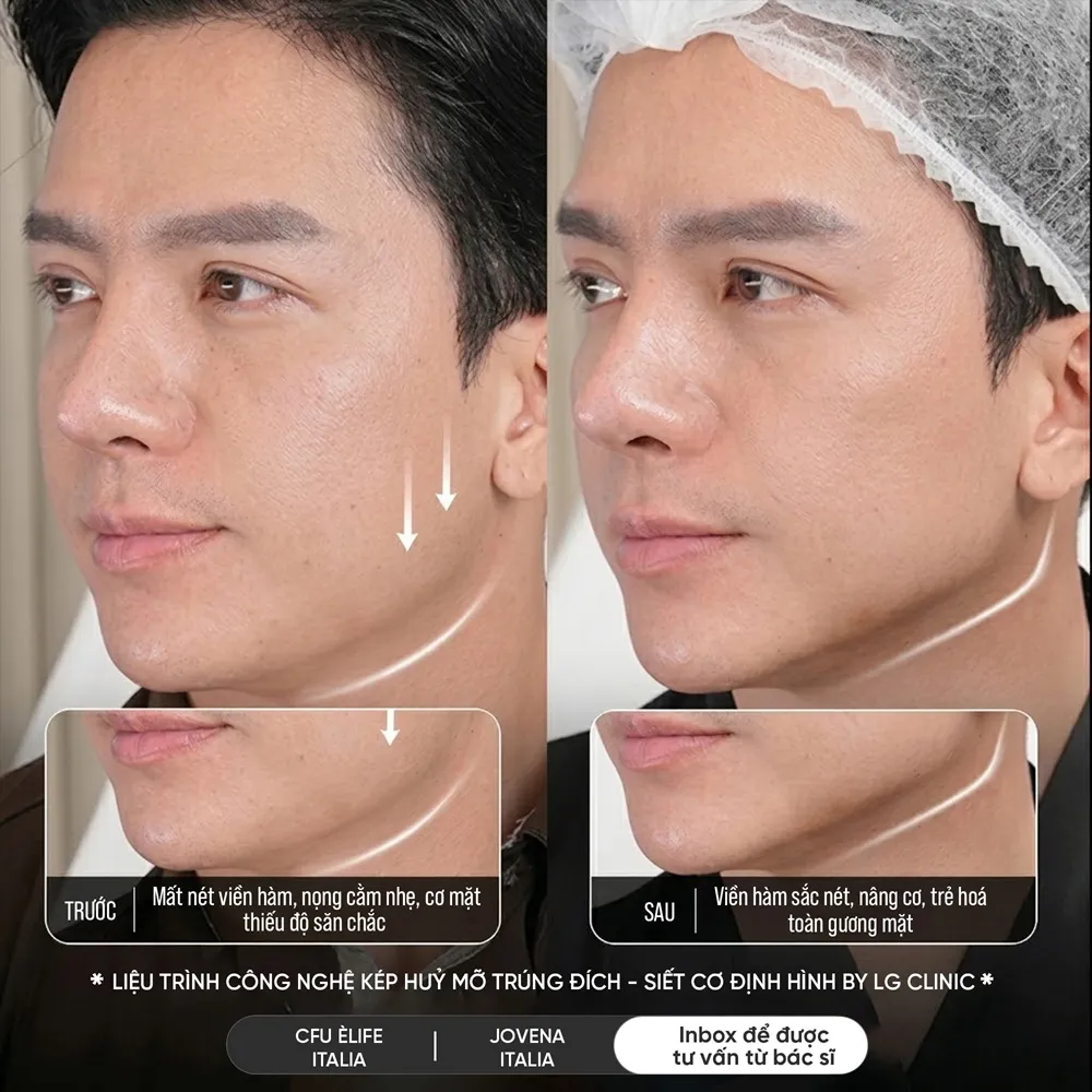 Hình ảnh ba định hình viền hàm