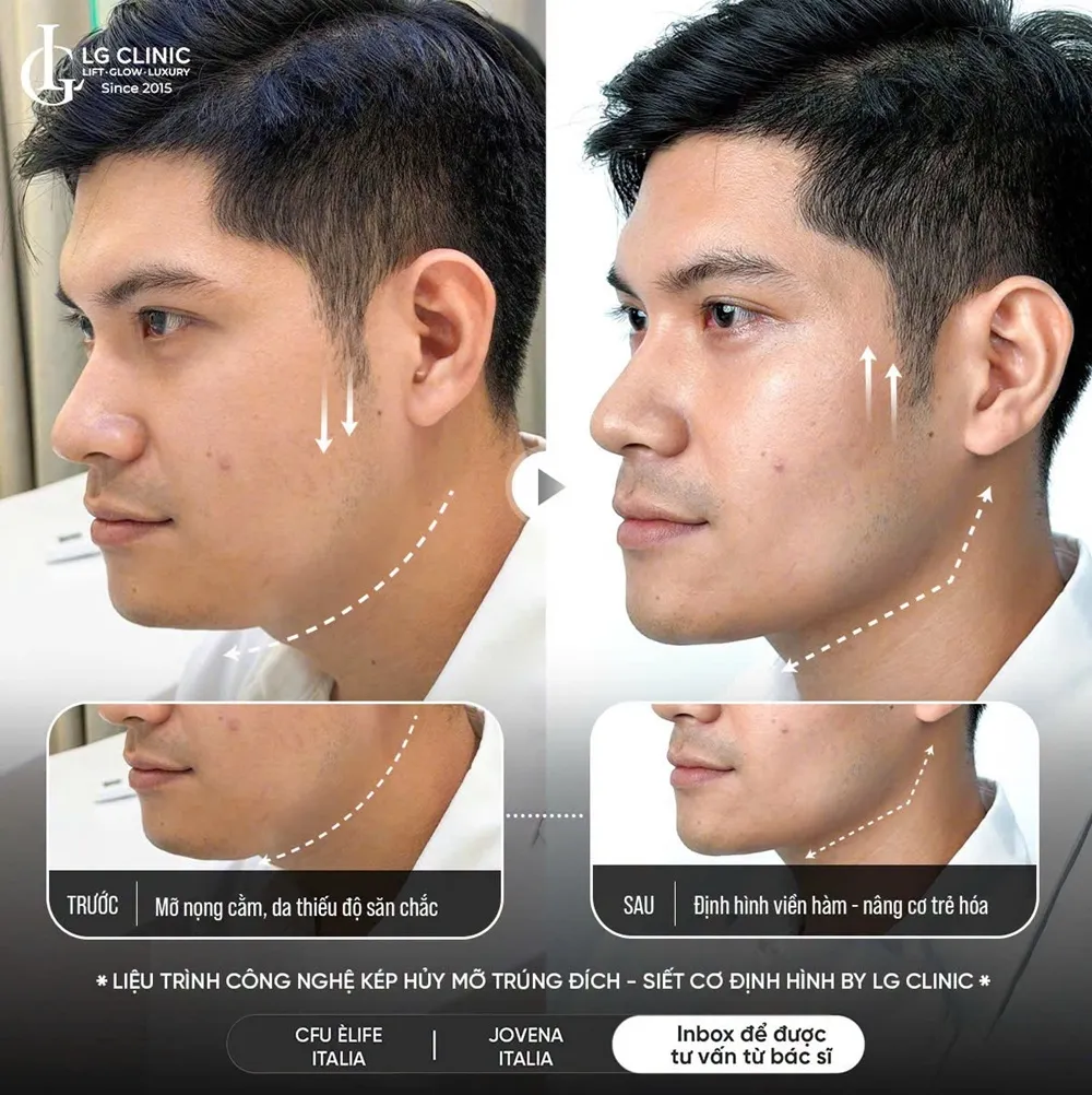 Hình ảnh ba định hình viền hàm