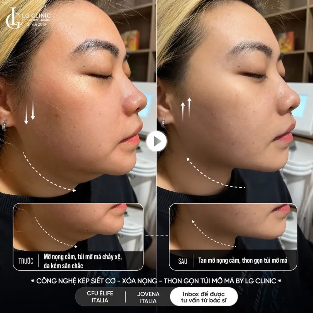 Hình ảnh ba định hình viền hàm