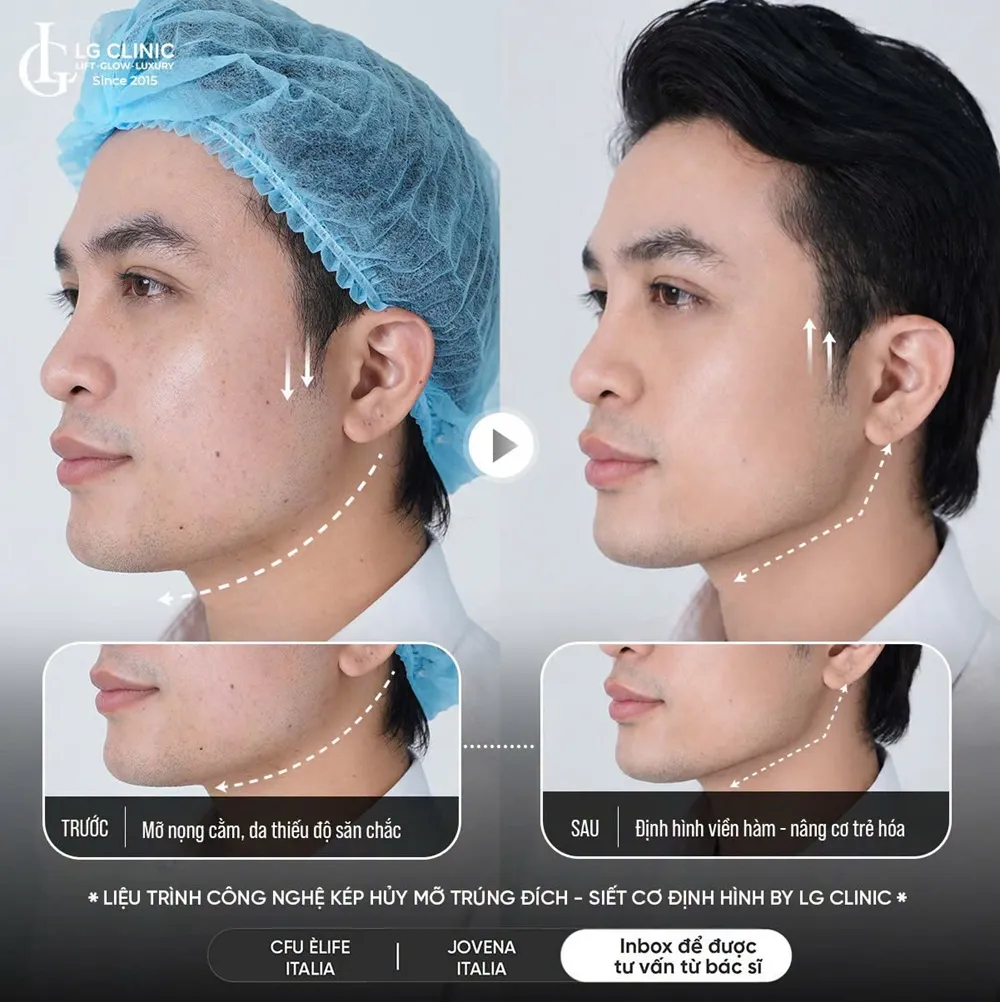 Hình ảnh ba định hình viền hàm
