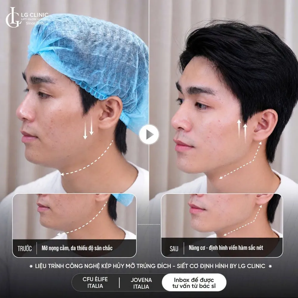 Hình ảnh ba định hình viền hàm