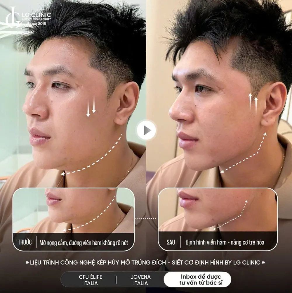Hình ảnh ba định hình viền hàm