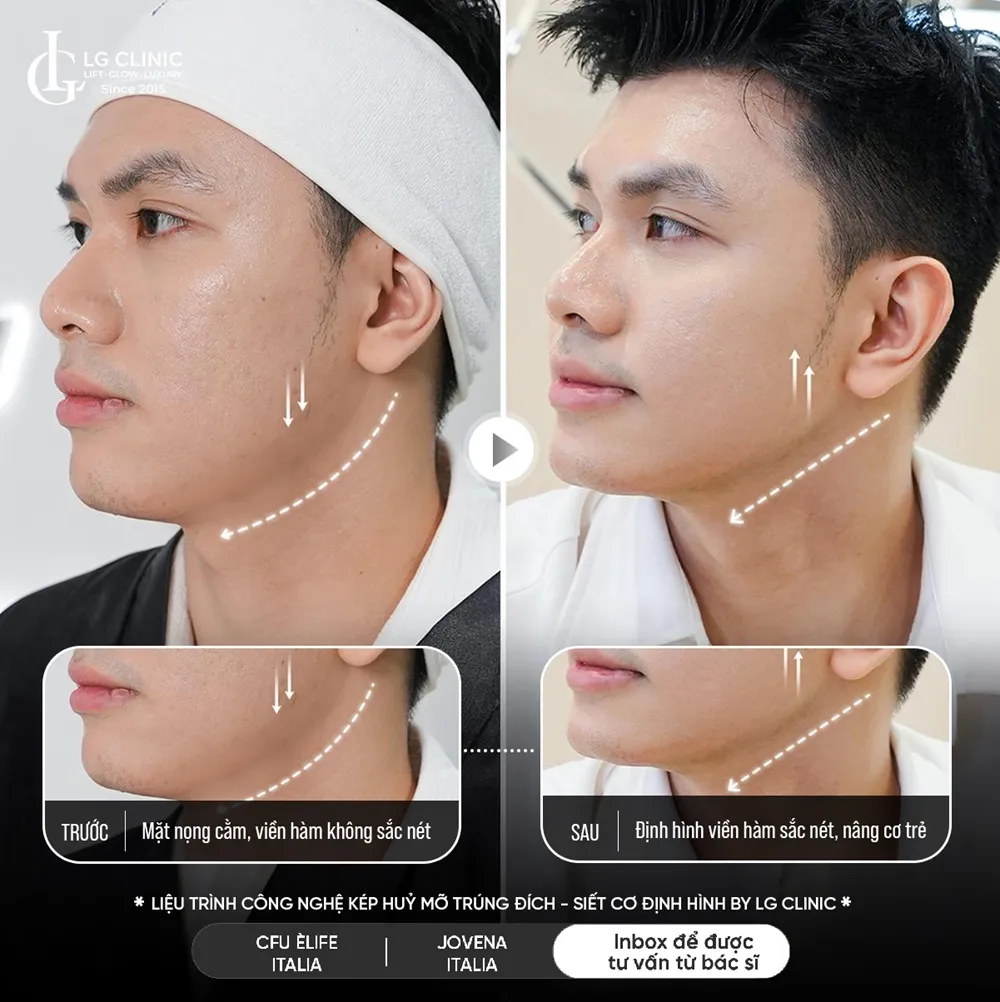Hình ảnh ba định hình viền hàm