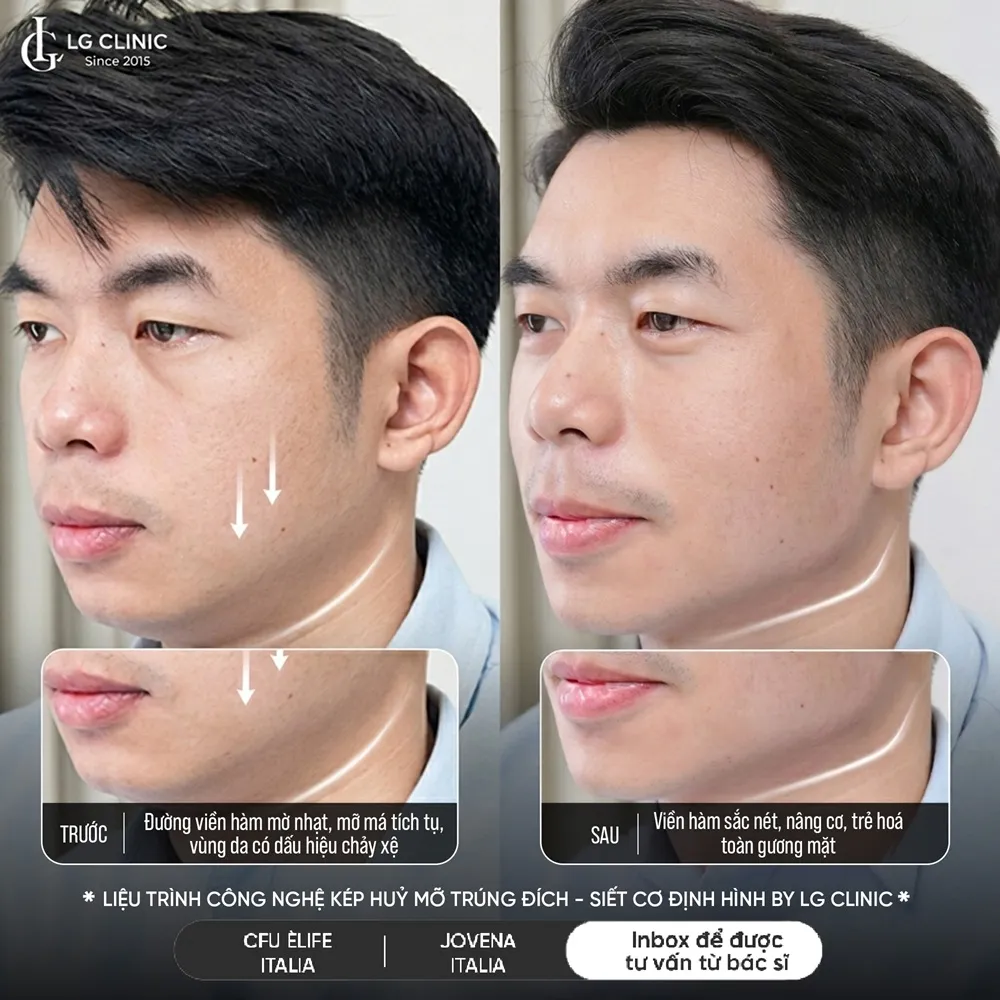 Hình ảnh ba định hình viền hàm