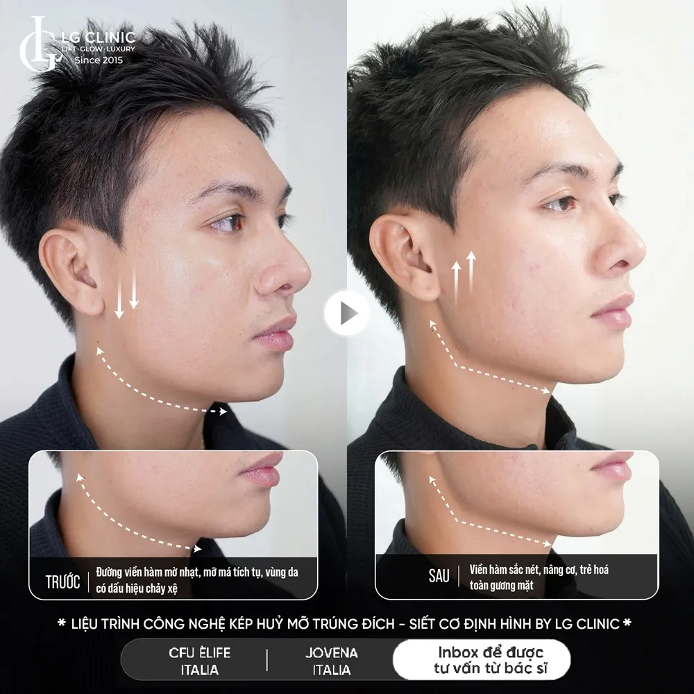 Hình ảnh ba định hình viền hàm