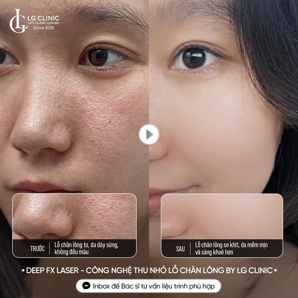 hình ảnh ba thu nhỏ lỗ chân lông