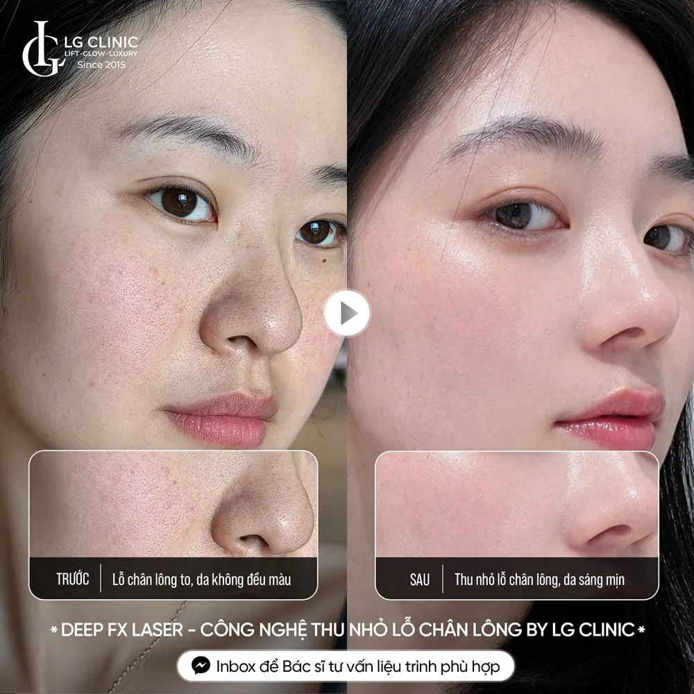 hình ảnh ba thu nhỏ lỗ chân lông
