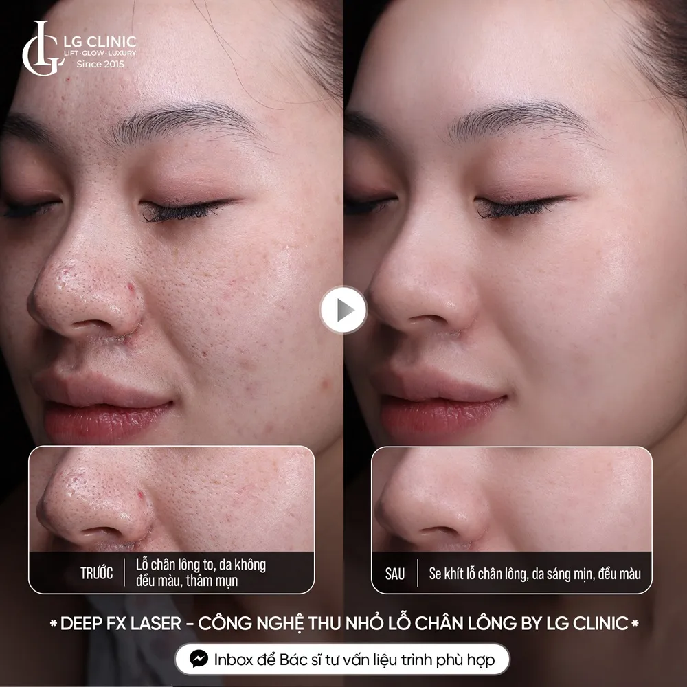 hình ảnh ba thu nhỏ lỗ chân lông