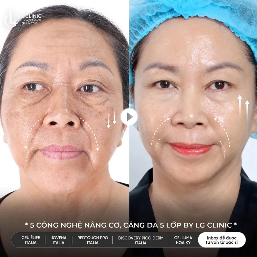 Hình ảnh ba trẻ hóa khuôn mặt