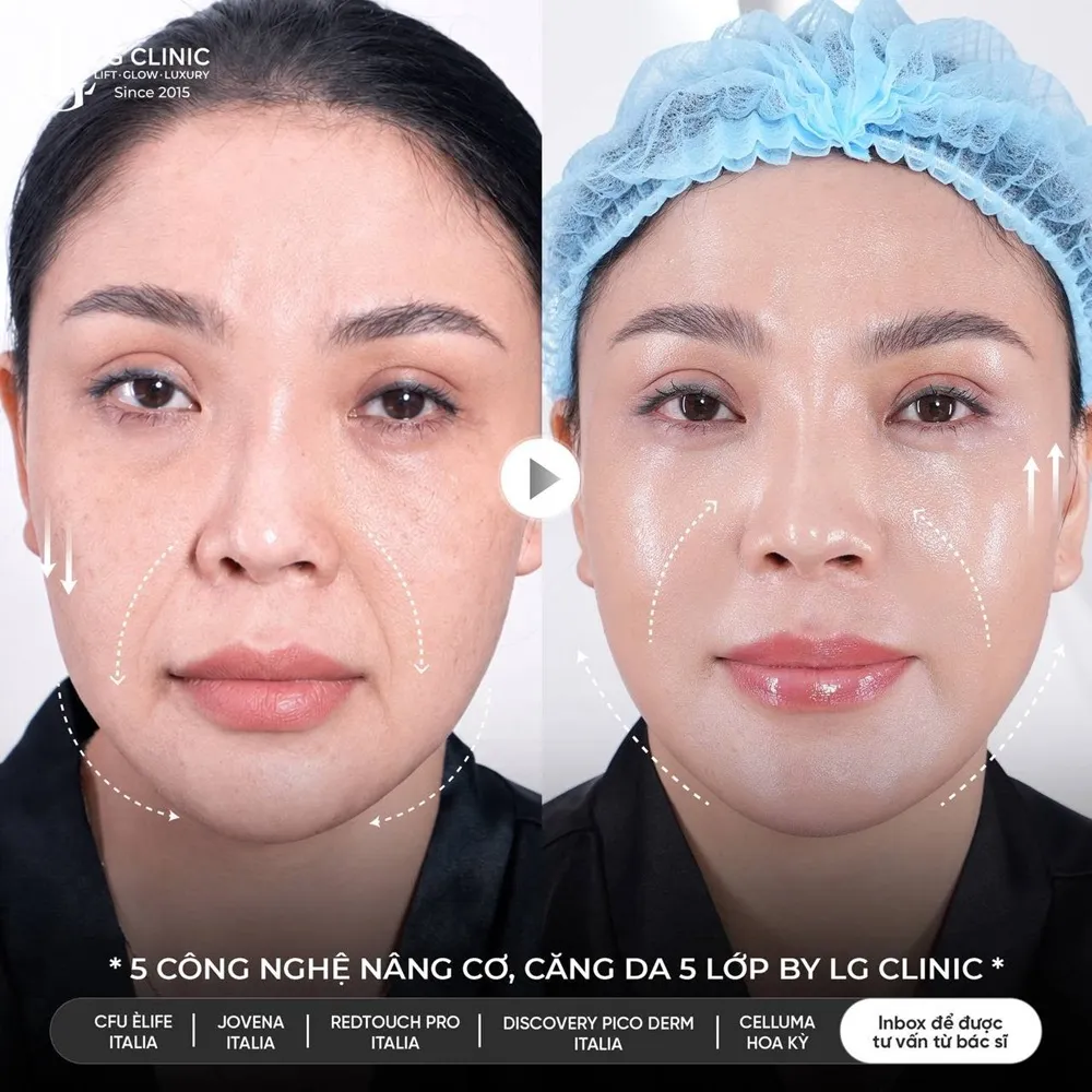 Hình ảnh ba trẻ hóa khuôn mặt