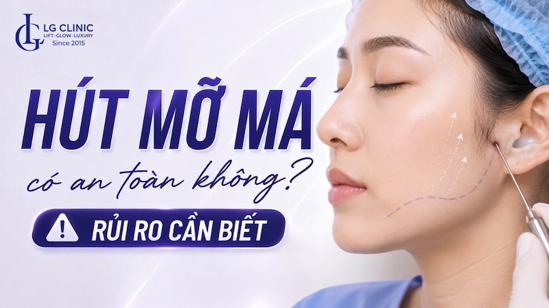 hút mỡ má