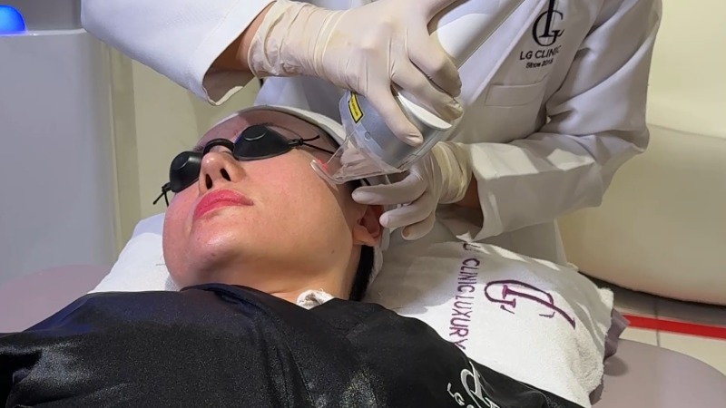 Spa thu nhỏ lỗ chân lông Quận 1