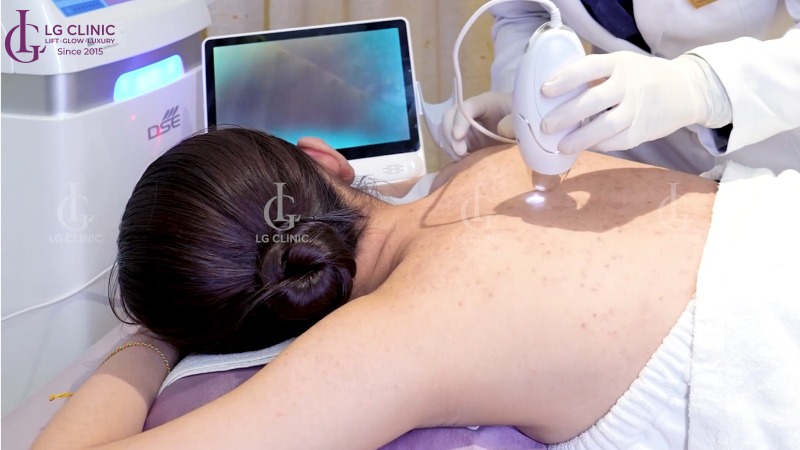 spa trị mụn lưng phú nhuận