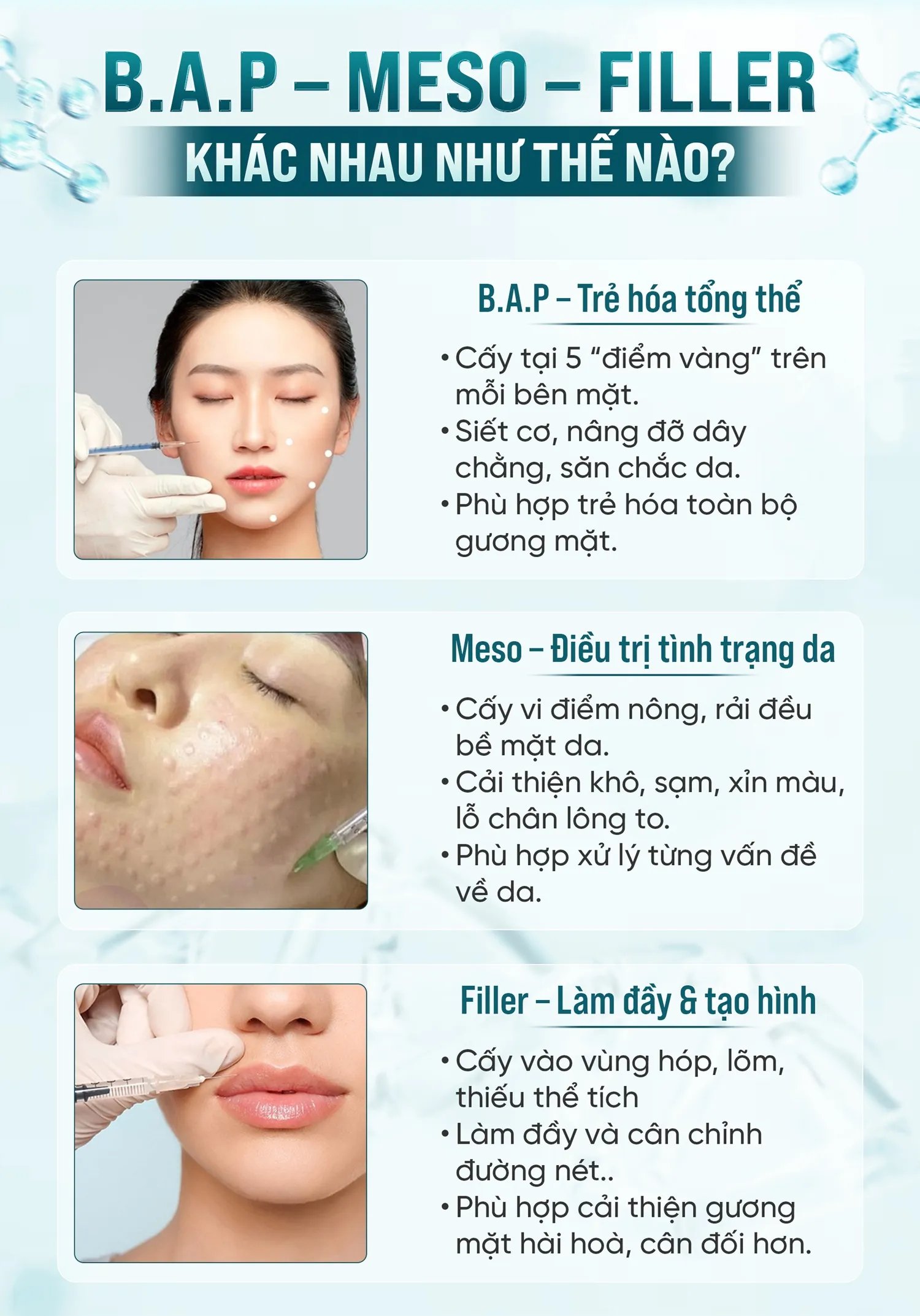 bap meso filler khác nhau như nào