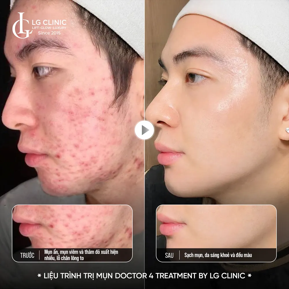 Hình ảnh ba doctor 4 treatment