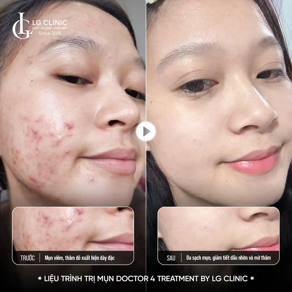 Hình ảnh ba doctor 4 treatment