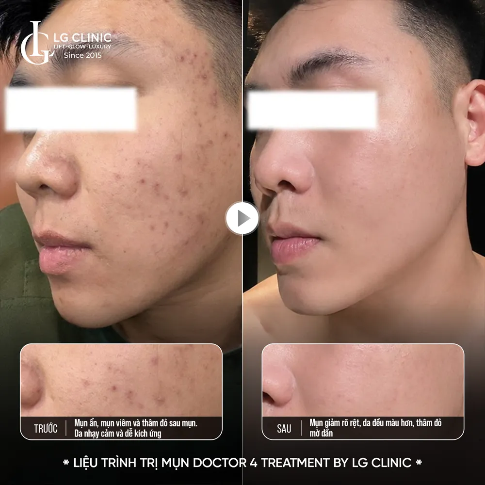 Hình ảnh ba doctor 4 treatment