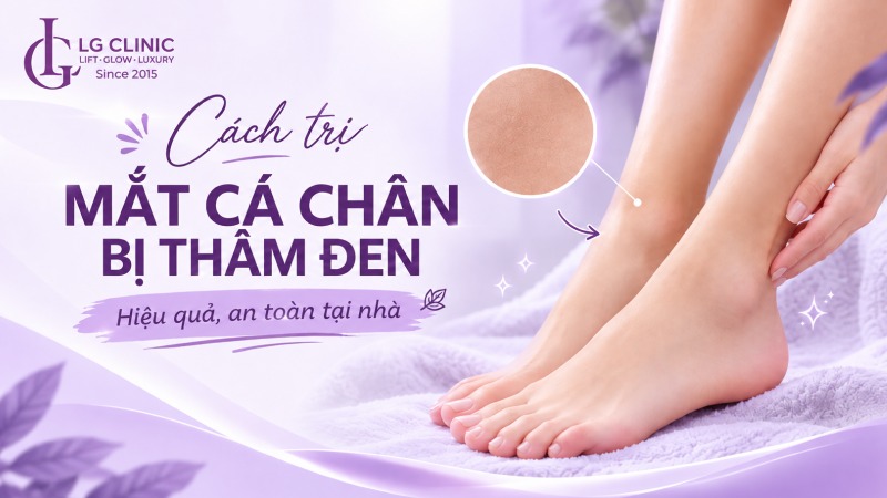 Cách trị mắt cá chân bị thâm đen
