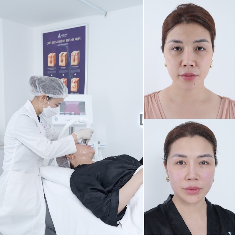 lg clinic lừa đảo