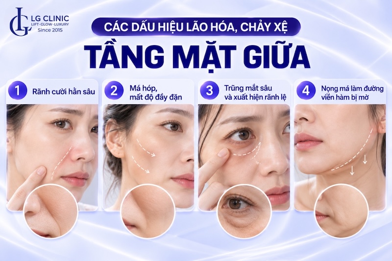 tầng mặt giữa là vùng nào