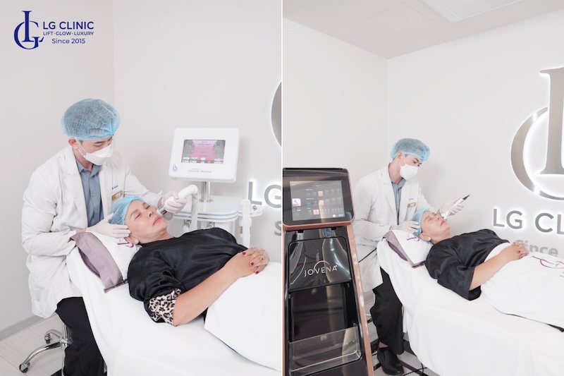 nâng cơ tầng mặt giữa