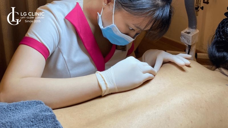 Spa trị mụn lưng Bình Dương